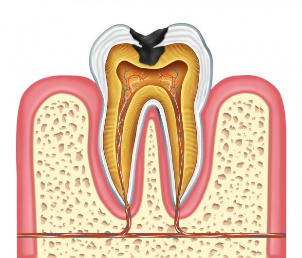مشکلات و بیماری های پالپ دندان