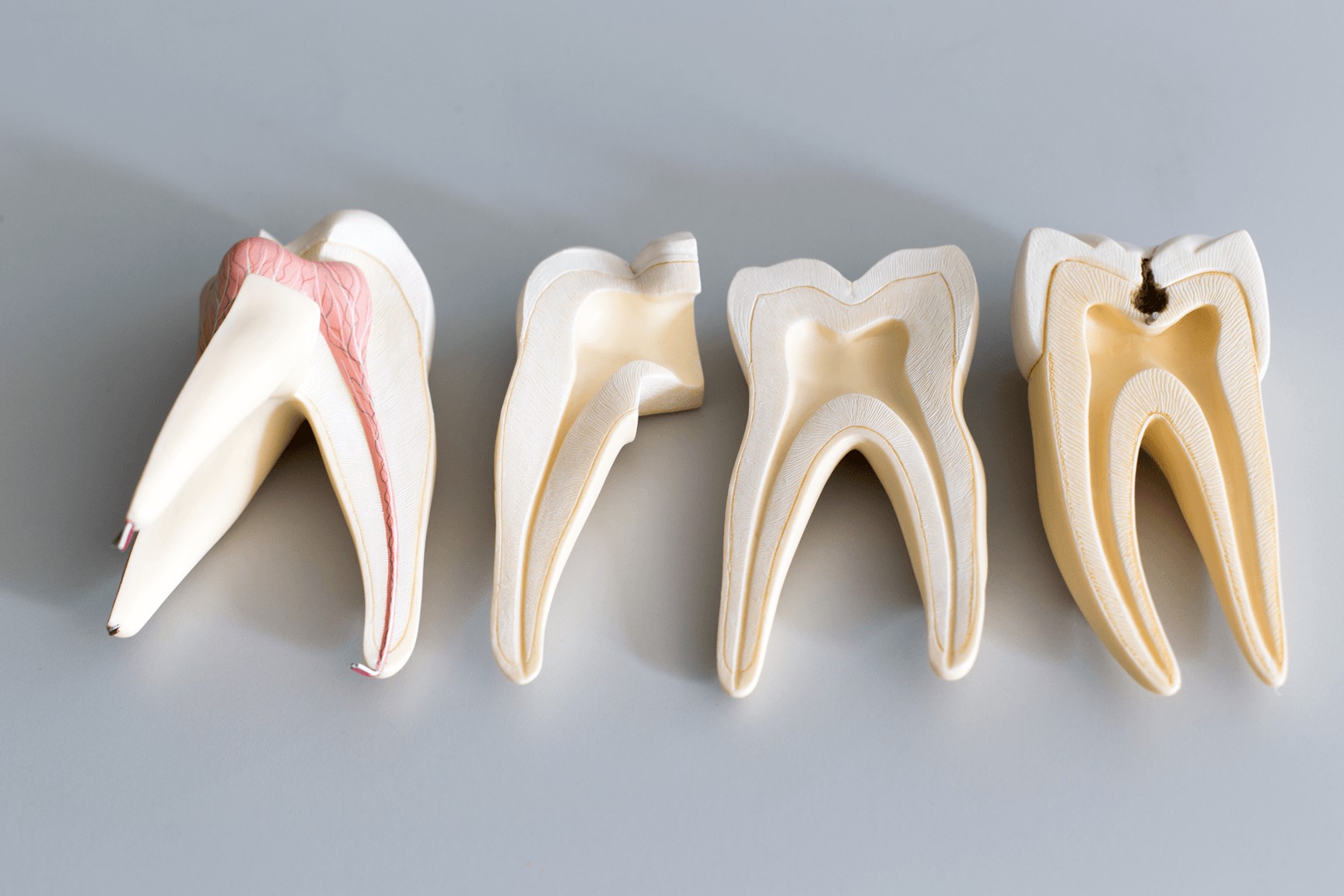علائم هشدار دهنده نیاز به درمان ریشه دندان