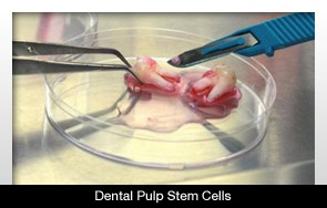 استفاده از سلول های بنیادی برای تولید مجدد پالپ دندان