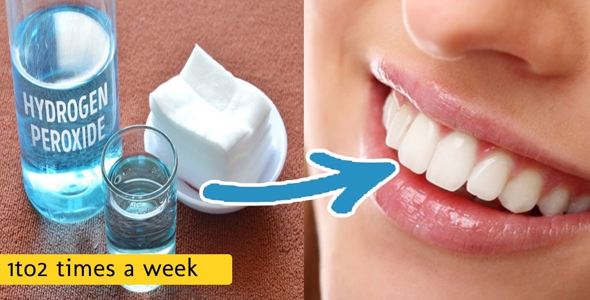 روش های طبیعی سفید کردن دندان ها در منزل