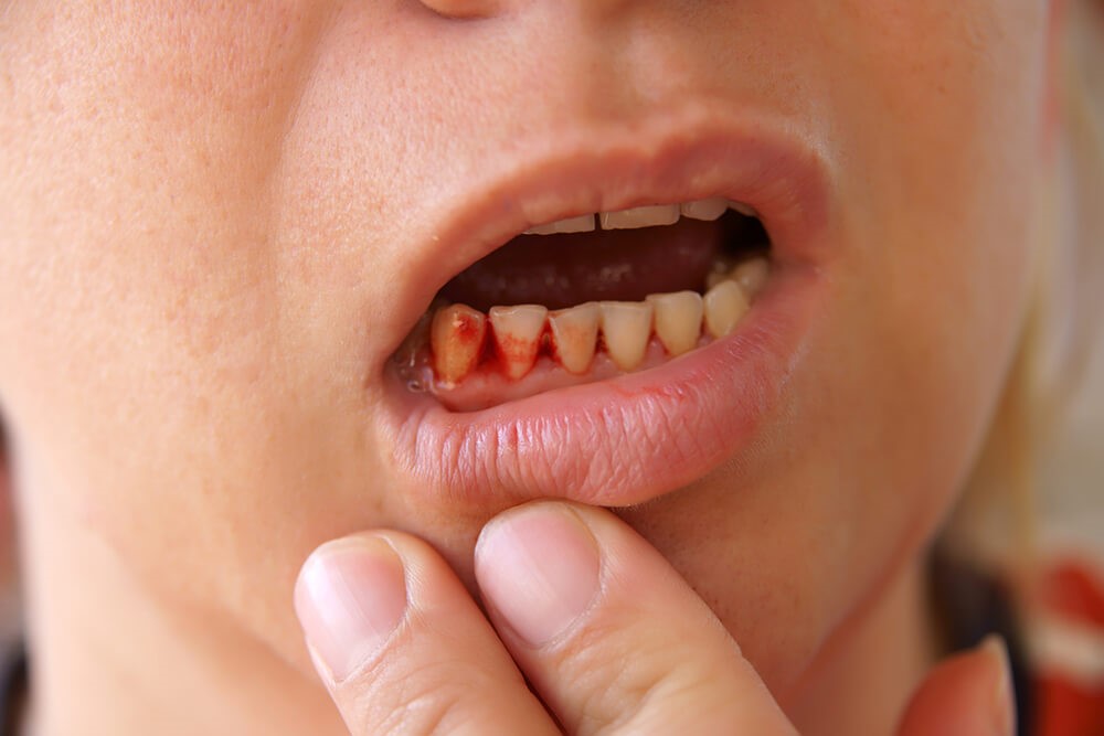 دندان صاف و سلامت بدن