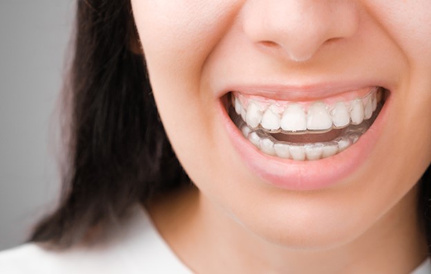 حساسیت دندان در ارتودنسی