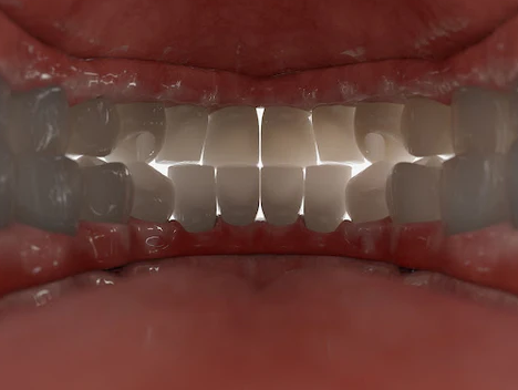 شکل صحیح قرار گرفتن دندانها روی هم