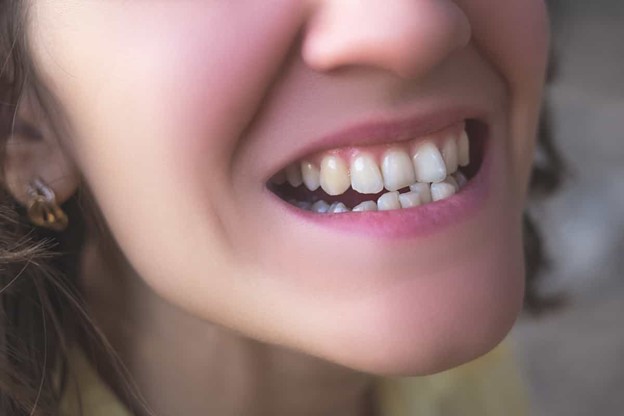 علت نامرتبی دندان با بالا رفتن سن
