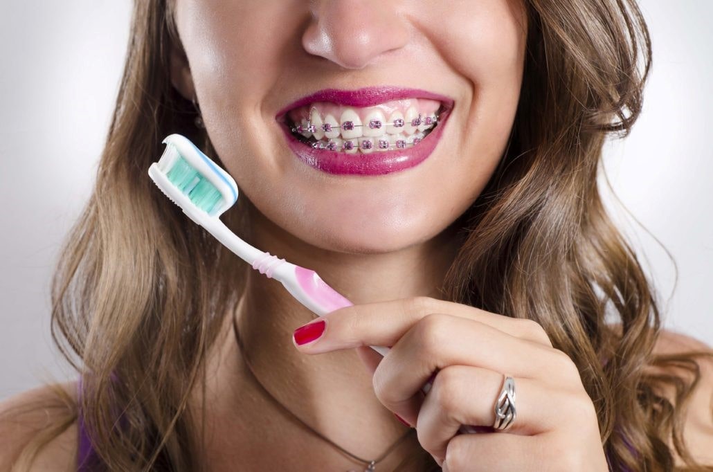 خمیر دندان مناسب برای جلوگیری از آسیب به ارتودنسی
