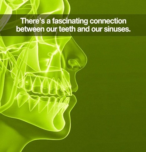 نکات پیشگیری از درد سینوسی دندان