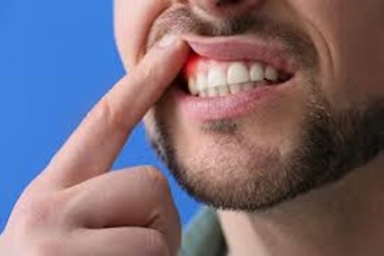 پس علائم آبسه دندان چه هستند؟