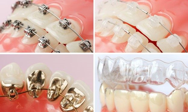 جابجایی های ظریف: علائم اولیه پیشرفت