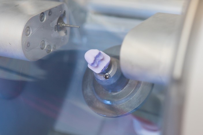 آشنایی با روش روکش دندان یک روزه